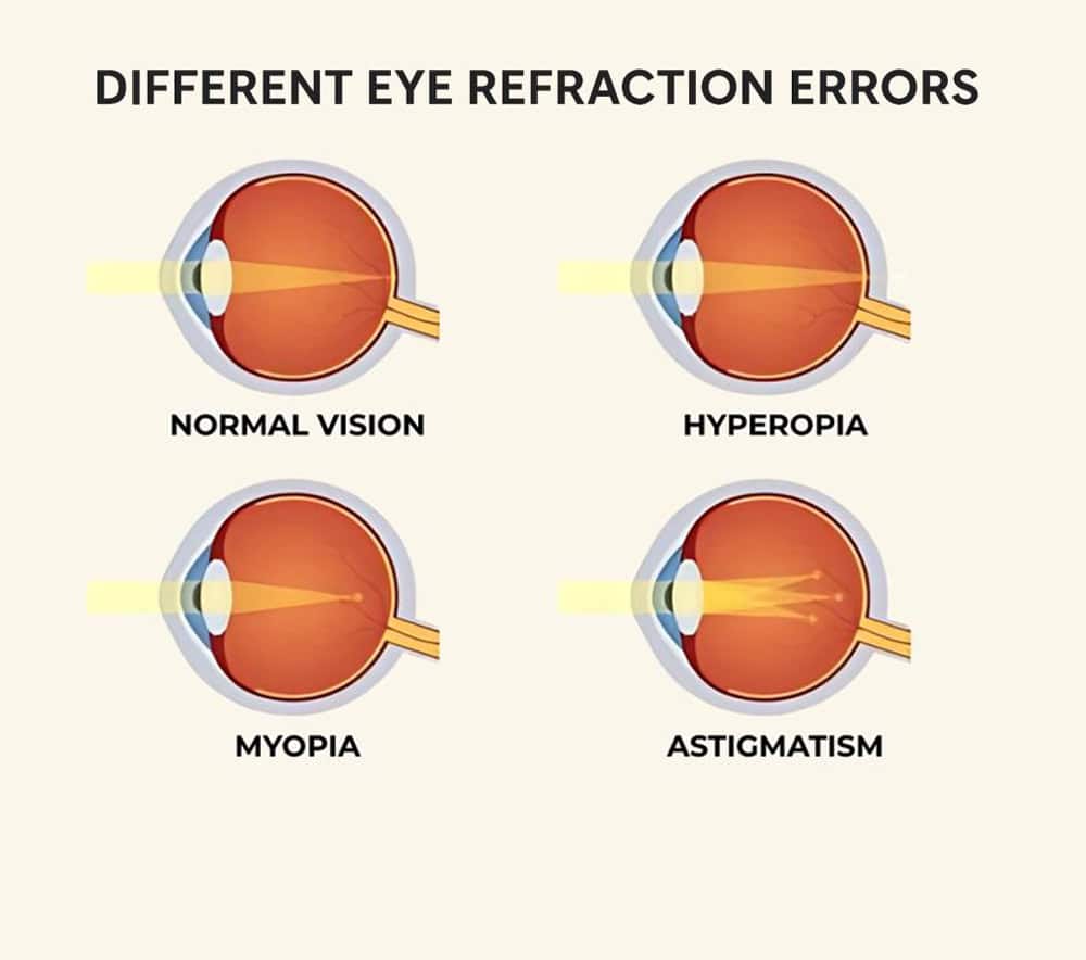is-20-40-vision-bad-refraction-errors-1024x683